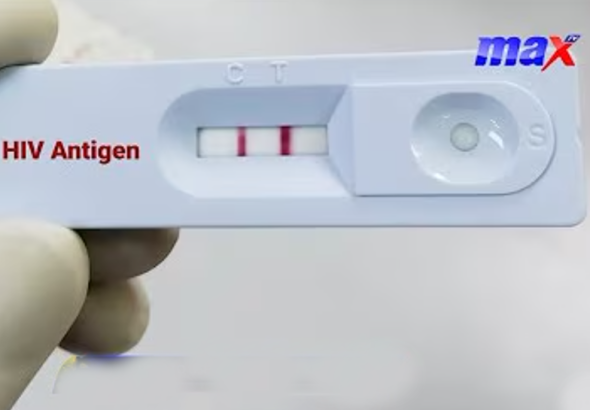 hiv-test