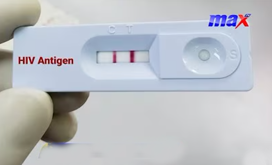 hiv-test